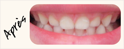Visuels-Dents-2