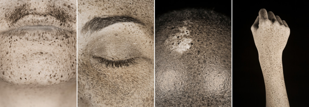 Exemple de photovieillissement rélévé en UV - ©Pierre-Louis Ferrer