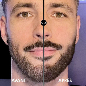 AVANT/APRES